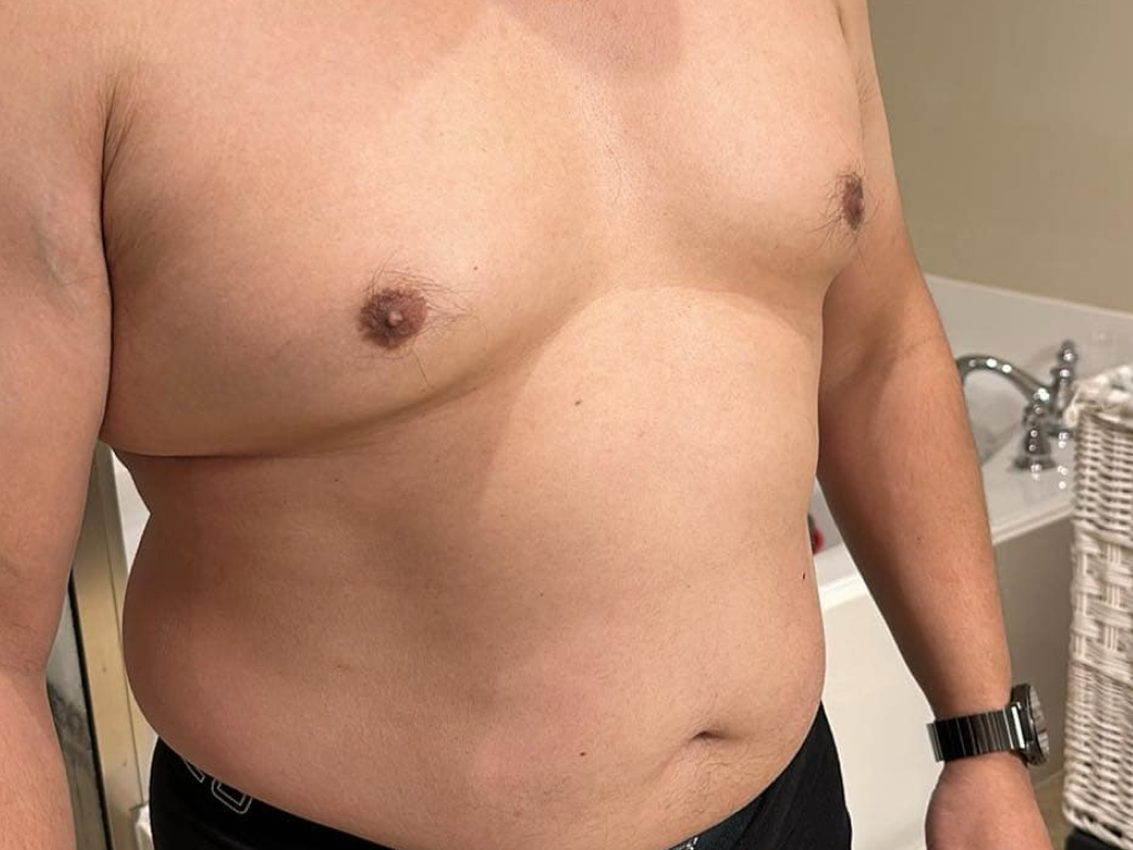 green-cap-after-weight-loss-john