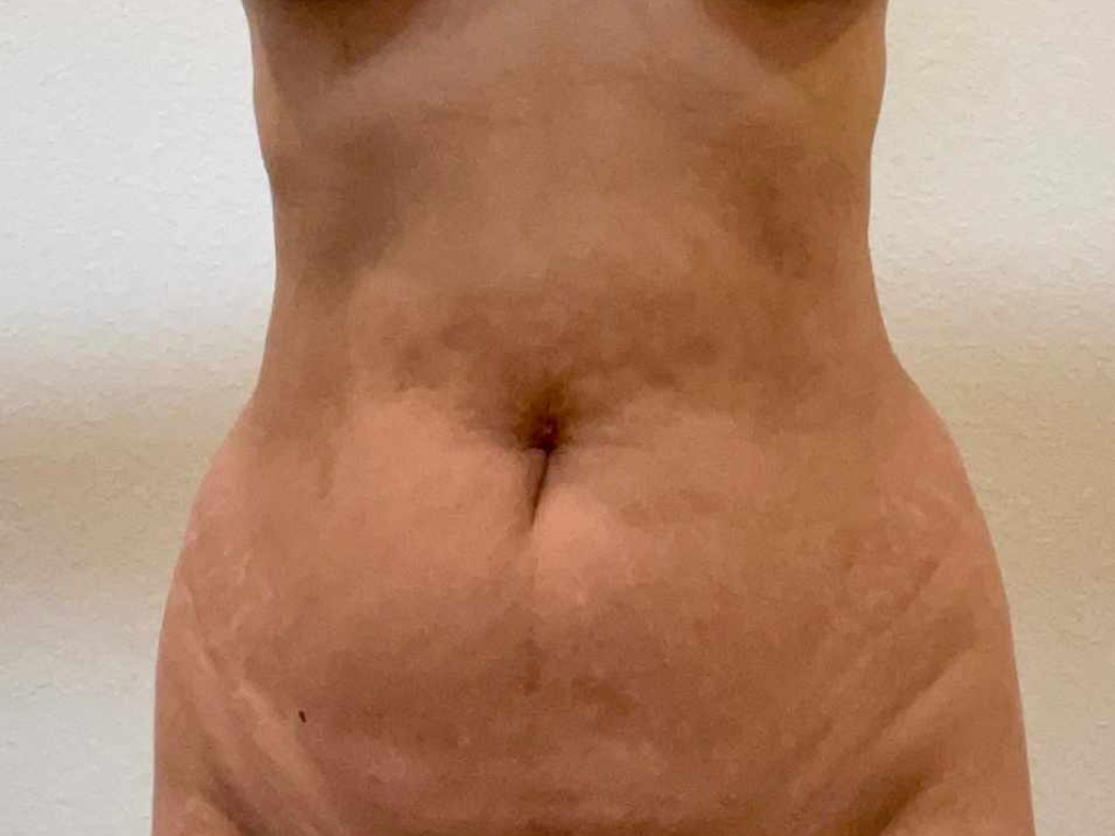 green-cap-after-weight-loss-pauline