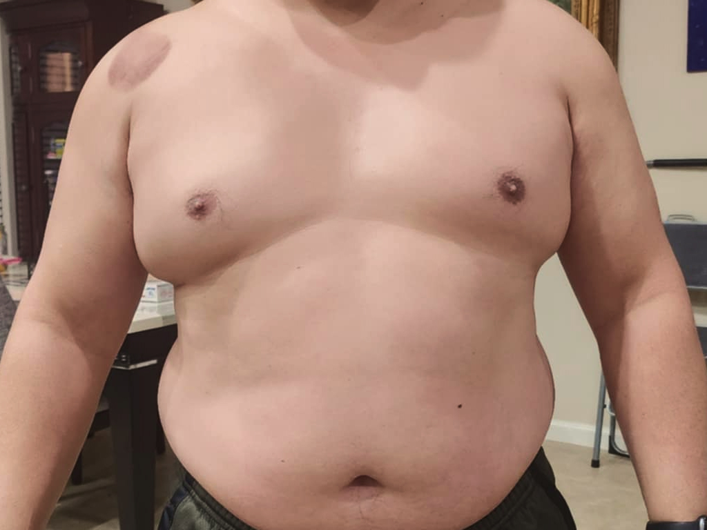 green-cap-before-weight-loss-john