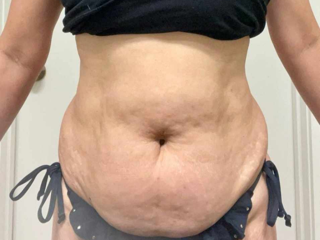 green-cap-before-weight-loss-pauline