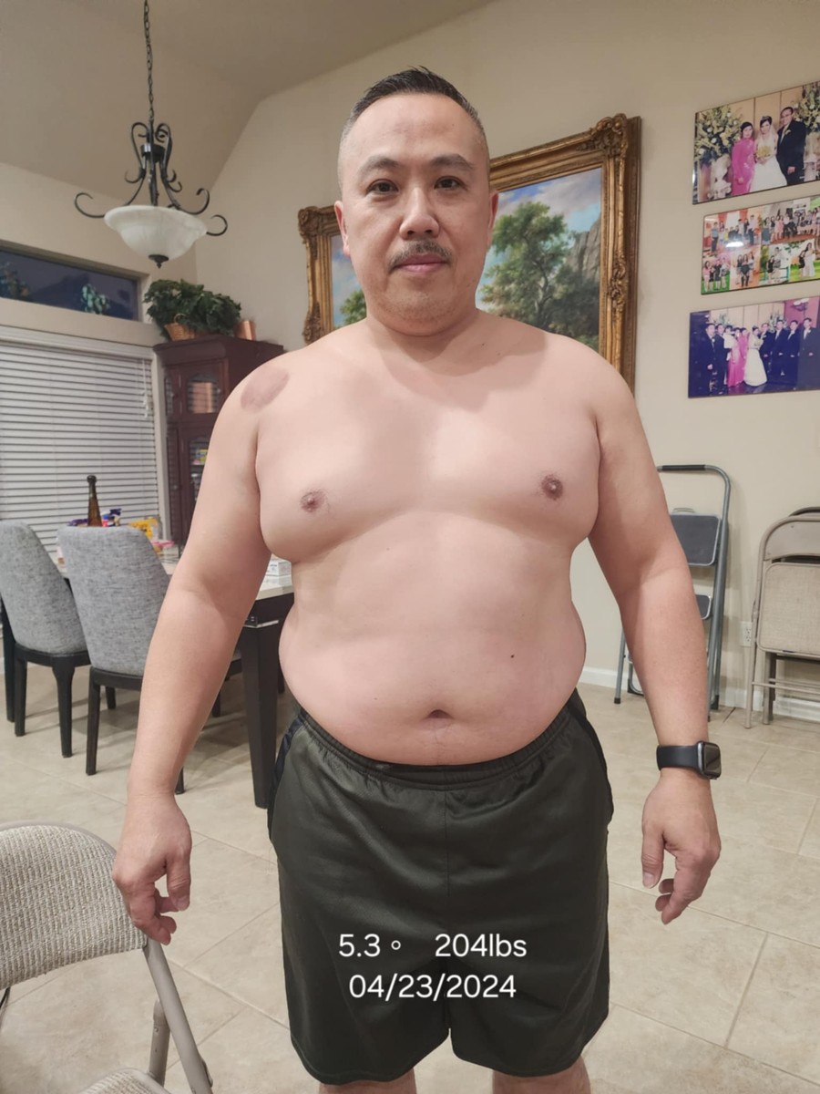 Green Cap weight loss patient progress - John