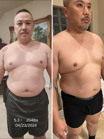 Patient progress - John